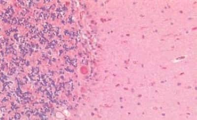 Immunohistochemistry-Paraffin: GAD65/67 Antibody [NBP3-14328] - Human Brain, Cerebellum: Formalin-Fixed, Paraffin-Embedded (FFPE)